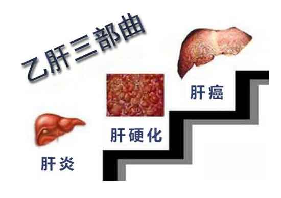 郑州看肝病最好的医院是哪个