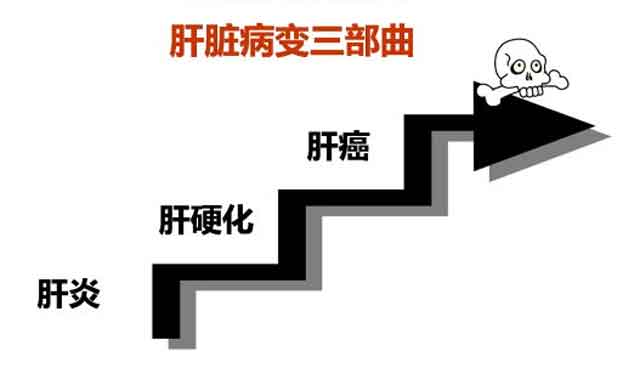 郑州专业看肝硬化医院?郑州肝硬化治疗医院在哪里