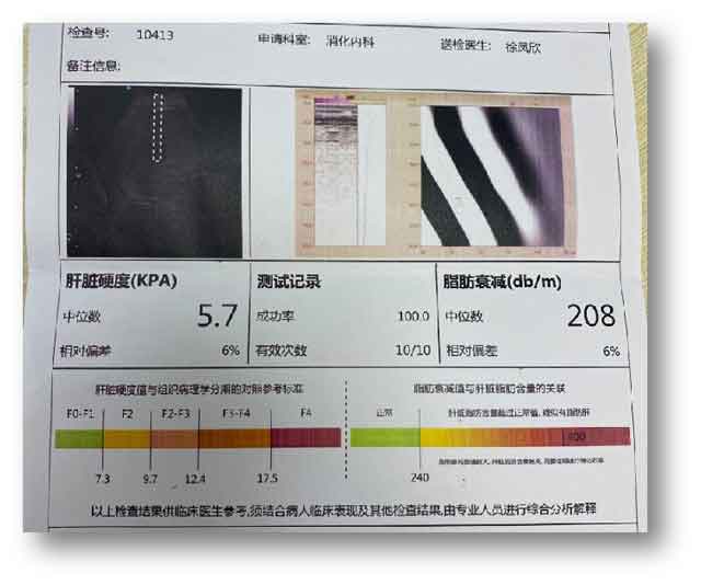 郑州哪个医院肝病科好?河南有几家肝病医院