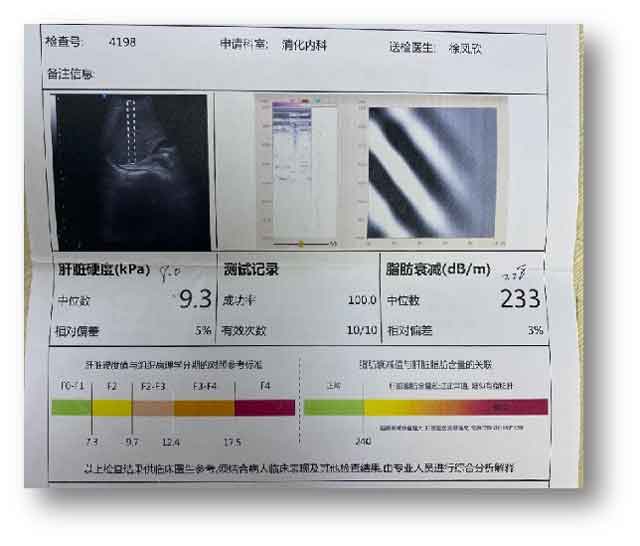 郑州哪个医院肝病科好?河南有几家肝病医院