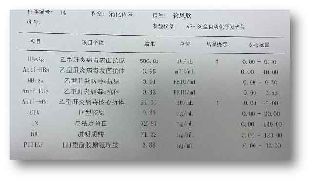 郑州哪个医院肝病科好?河南有几家肝病医院