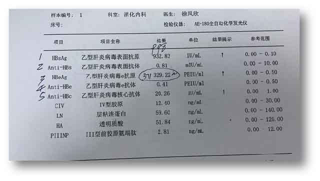 郑州哪个医院肝病科好?河南有几家肝病医院