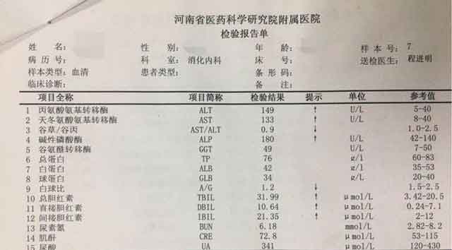 郑州那家医院看肝硬化好?郑州治疗肝硬化好的医院