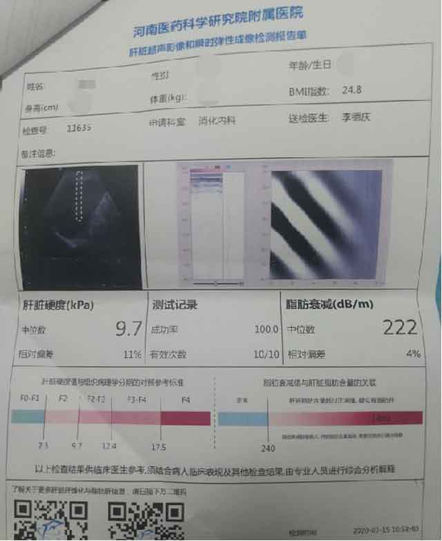 郑州看肝硬化的专科医院哪家好