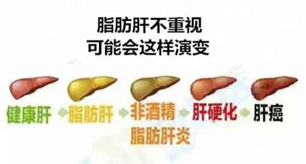 科学预防、少走弯路,肝病诊疗要精准施策
