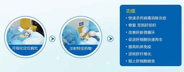 河南郑州市哪个肝病医院治疗肝硬化好
