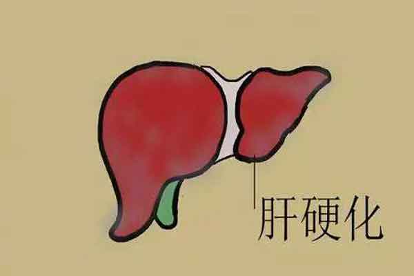 河南郑州市哪个肝病医院治疗肝硬化好