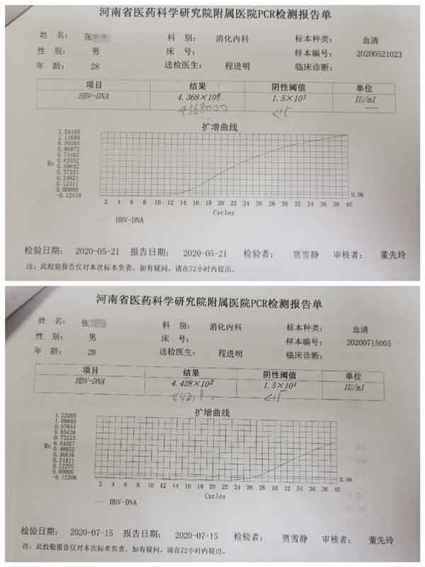 郑州乙肝大三阳正规医院