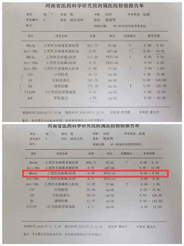 郑州乙肝大三阳正规医院