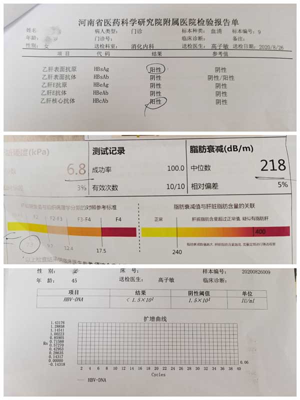 郑州那家医院治疗乙肝有效
