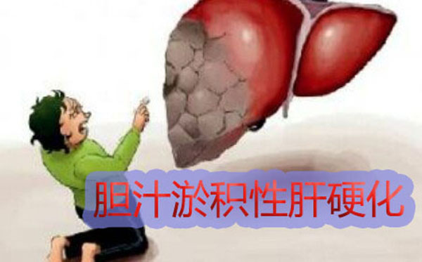 【庄淑英主任案例分享】六次软肝治疗,肝弹检查16.9恢复至7.0